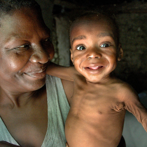 Give a gift that matters: a donation in your friend's name. Your gift will provide food for the family of a malnourished child for two months.