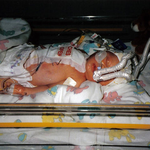 Give a gift that matters: a donation in your friend's name. Childrens Cross Connection International can provide pediatric ventilators and nebulizers to these f